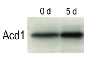 ACD1 | Accelerated cell death 1 in the group Antibodies Plant/Algal / Plant Developmental Biology / Senescence/Cell death at Agrisera AB (Antibodies for research) (AS11 1783)